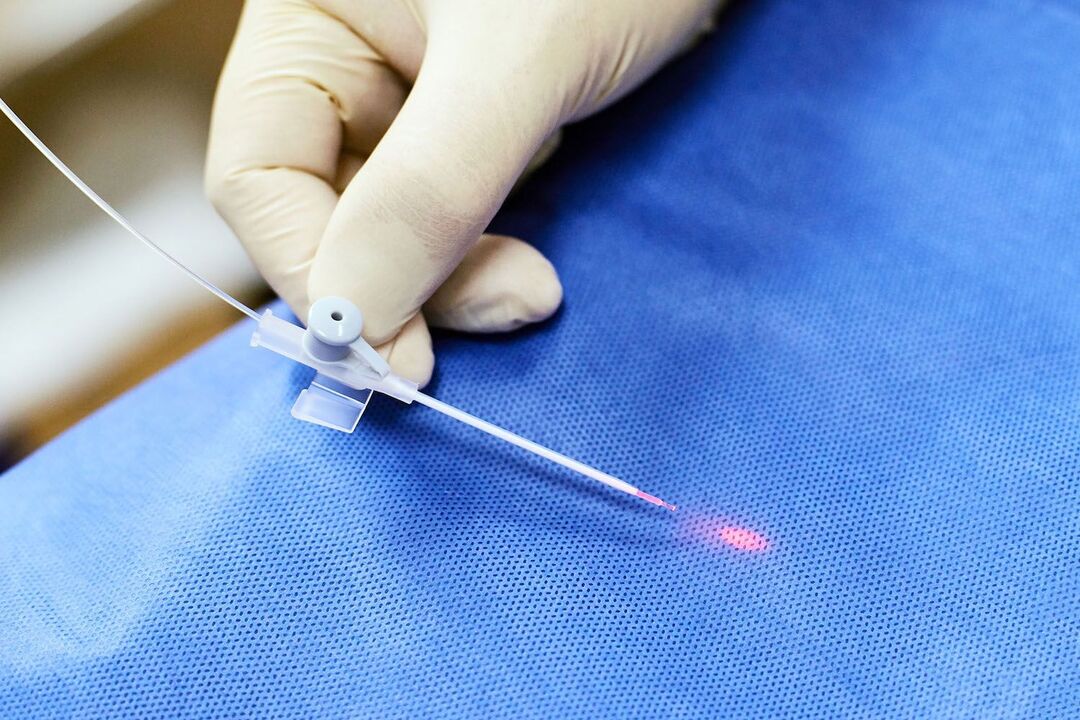 трансректално устройство за лечение на простата